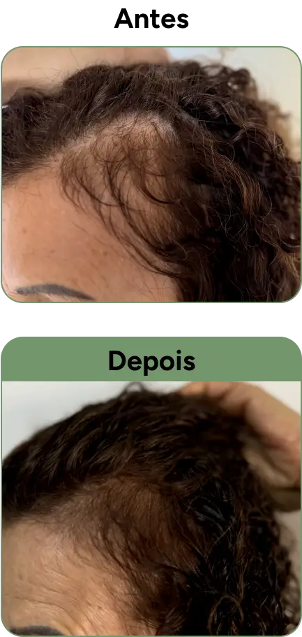 Resultado antes e depois do uso do produto