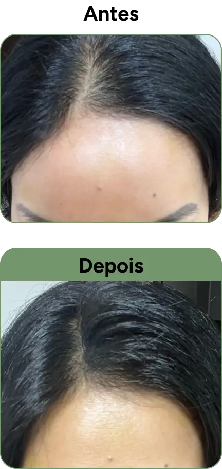 Resultado antes e depois do uso do produto